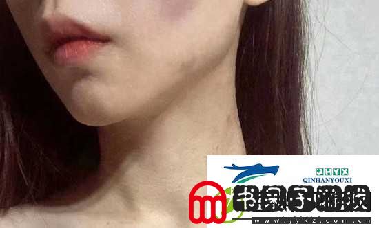 红雅典娜LIYA死了吗